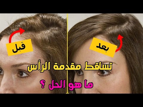 شاهد وصفة رائعة للشعر الخفيف والمتساقط