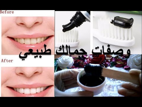 طريقة إعداد المعجون الأسود لتبييض الأسنان