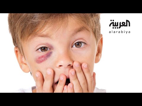 شاهد طريقة لحماية عيون الأطفال من هذه الألعاب