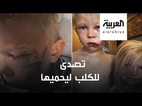 شاهد طفل بريطاني يواجه كلبًا ضالًا دفاعًا عن شقيقته