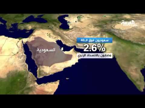 التدخين من أبرز أسباب الإصابة بالانسداد الرئوي